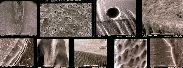 Aquestes són una mostra d'algunes de les imatges d'una investigació realitzada en clínica dental Padrós amb un microscopi electrònic i que va ser publicat en una de les revistes científiques nacionals i estrangeres
