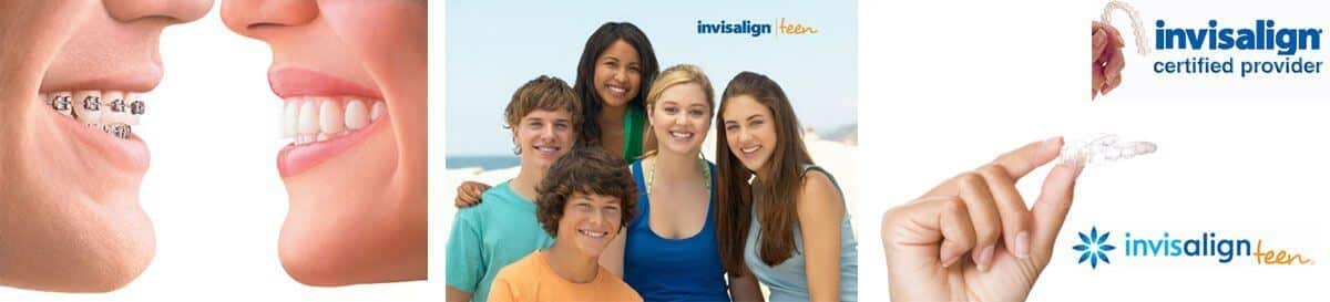 La clínica dental Padrós a Barcelona disposa del tractament d'ortodòncia invisible invisalign, aparells transparents i extraïbles La clínica dental Padrós a Barcelona disposa del tractament d'ortodòncia invisible invisalign, aparells transparents i extraïbles