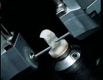 Imatges d'un cas real en clínica dental Padrós amb el sistema CEREC CAD-CAM. Amb l'ús del programari de disseny podem millorar el disseny i creació de restauracions dentals, especialment pròtesis dentals incloent corones, caretes, ponts, implants i aparells d'ortodòncia Imatges d'un cas real en clínica dental Padrós amb el sistema CEREC CAD-CAM. Amb l'ús del programari de disseny podem millorar el disseny i creació de restauracions dentals, especialment pròtesis dentals incloent corones, caretes, ponts, implants i aparells d'ortodòncia