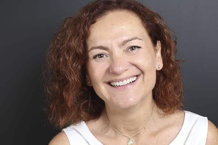 Després de l'estudi d'estètica dental Després de l'estudi d'estètica dental