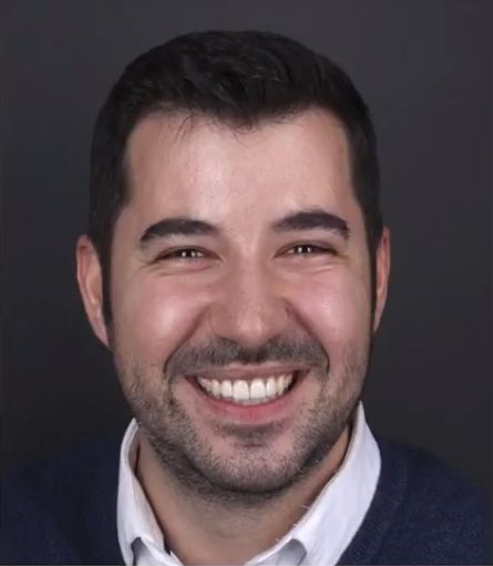 Cas dental Lluís: tractament d’ortodòncia i carilles de porcellana