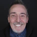 Cas dental Joaquín: tractament d’estètica dental